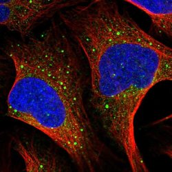 Invitrogen MSH5 Polyclonal Antibody 100 &mu;L; Unconjugated:Antibodies,