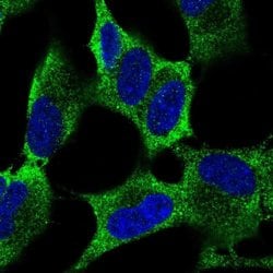 Invitrogen RKHD4 Polyclonal Antibody 100 &mu;L; Unconjugated:Antibodies,