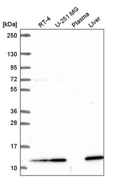 Invitrogen TMEM256 Polyclonal Antibody 100 &mu;L; Unconjugated:Antibodies,