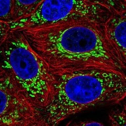 Invitrogen DNLZ Polyclonal Antibody 100 &mu;L; Unconjugated:Antibodies,