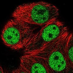 Invitrogen ATXN1L Polyclonal Antibody 100 &mu;L; Unconjugated:Antibodies,