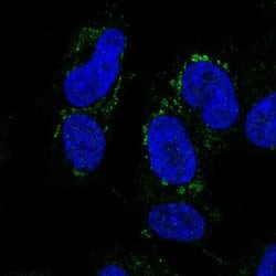 Invitrogen DMRTA2 Polyclonal Antibody 100 &mu;L; Unconjugated:Antibodies,