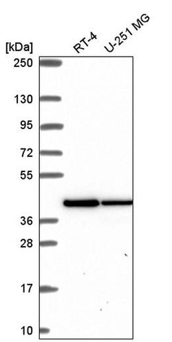 Invitrogen IDH3A Polyclonal Antibody 100 &mu;L; Unconjugated:Antibodies,