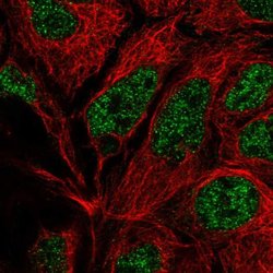 POLR2E Polyclonal Antibody:Antibodies, Polyclonal