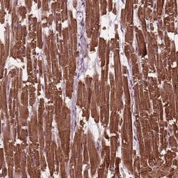 Invitrogen MYL3 Polyclonal Antibody 100 &mu;L; Unconjugated:Antibodies,