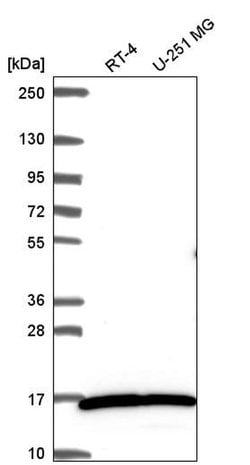 Invitrogen MYL3 Polyclonal Antibody 100 &mu;L; Unconjugated:Antibodies,