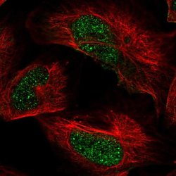 Invitrogen ARID2 Polyclonal Antibody 100 &mu;L; Unconjugated:Antibodies,