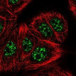 Invitrogen SLC2A4RG Polyclonal Antibody 100 &mu;L; Unconjugated:Antibodies,