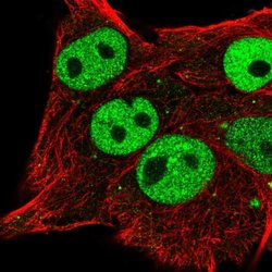 Invitrogen ETV5 Polyclonal Antibody 100 &mu;L; Unconjugated:Antibodies,