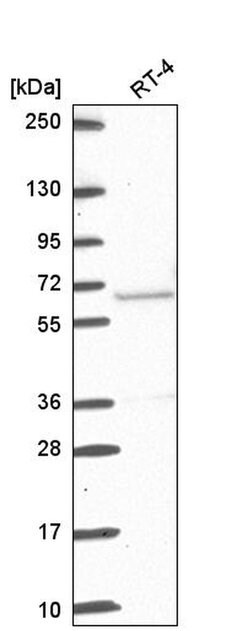 Invitrogen ETV5 Polyclonal Antibody 100 &mu;L; Unconjugated:Antibodies,