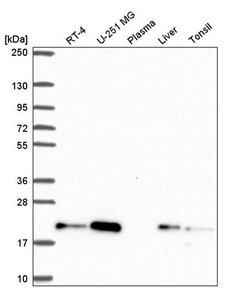 Invitrogen ZNF9 Polyclonal Antibody 100 &mu;L; Unconjugated:Antibodies,
