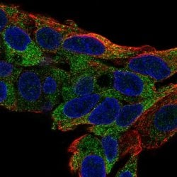 Invitrogen TTC39B Polyclonal Antibody 100 &mu;L; Unconjugated:Antibodies,