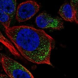 Invitrogen TPRG1L Polyclonal Antibody 100 &mu;L; Unconjugated:Antibodies,