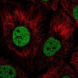 Invitrogen BNC1 Polyclonal Antibody 100 &mu;L; Unconjugated:Antibodies,