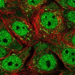 Invitrogen SERTAD1 Polyclonal Antibody 100 &mu;L; Unconjugated:Antibodies,