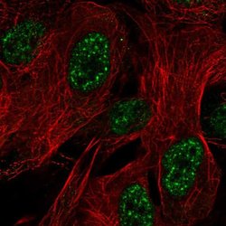Invitrogen ZNF441 Polyclonal Antibody 100 &mu;L; Unconjugated:Antibodies,