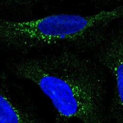 Invitrogen RDH5 Polyclonal Antibody 100 &mu;L; Unconjugated:Antibodies,
