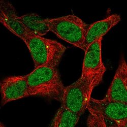 Invitrogen ZNF12 Polyclonal Antibody 100 &mu;L; Unconjugated:Antibodies,