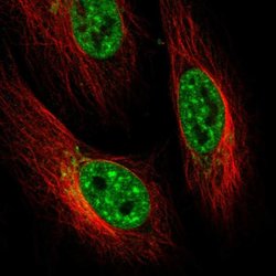 Invitrogen ENTHD2 Polyclonal Antibody 100 &mu;L; Unconjugated:Antibodies,
