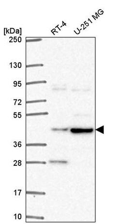 Invitrogen ENTHD2 Polyclonal Antibody 100 &mu;L; Unconjugated:Antibodies,