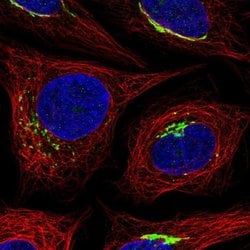Invitrogen MANEAL Polyclonal Antibody 100 &mu;L; Unconjugated:Antibodies,