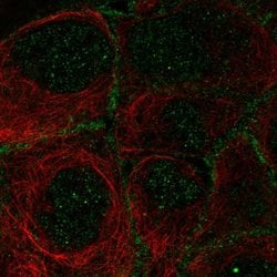 Invitrogen OSR2 Polyclonal Antibody 100 &mu;L; Unconjugated:Antibodies,