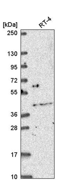 Invitrogen OSR2 Polyclonal Antibody 100 &mu;L; Unconjugated:Antibodies,