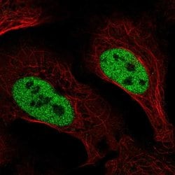 Invitrogen SLC4A3 Polyclonal Antibody 100 &mu;L; Unconjugated:Antibodies,