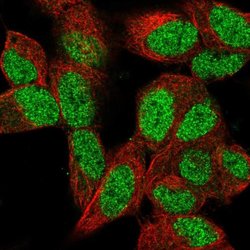 Invitrogen MEL18 Polyclonal Antibody 100 &mu;L; Unconjugated:Antibodies,