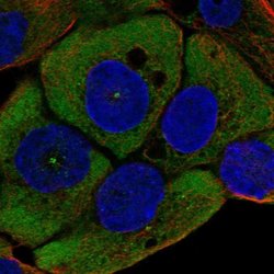 Invitrogen WNT11 Polyclonal Antibody 100 &mu;L; Unconjugated:Antibodies,