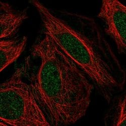 Invitrogen PFKFB2 Polyclonal Antibody 100 &mu;L; Unconjugated:Antibodies,