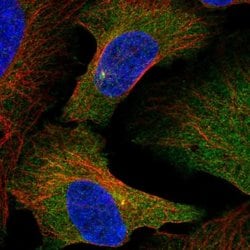 Invitrogen SLAIN2 Polyclonal Antibody 100 &mu;L; Unconjugated:Antibodies,