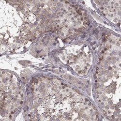 Invitrogen SLAIN2 Polyclonal Antibody 100 &mu;L; Unconjugated:Antibodies,