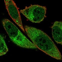 Invitrogen ABCA13 Polyclonal Antibody 100 &mu;L; Unconjugated:Antibodies,