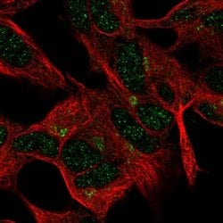 Invitrogen FEM1A Polyclonal Antibody 100 &mu;L; Unconjugated:Antibodies,