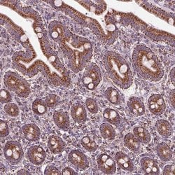 Invitrogen SLC25A24 Polyclonal Antibody 100 &mu;L; Unconjugated:Antibodies,
