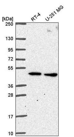 Invitrogen SLC25A24 Polyclonal Antibody 100 &mu;L; Unconjugated:Antibodies,