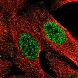 Invitrogen MED22 Polyclonal Antibody 100 &mu;L; Unconjugated:Antibodies,