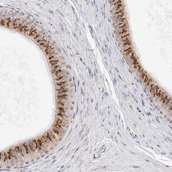 Invitrogen YIPF3 Polyclonal Antibody 100 &mu;L; Unconjugated:Antibodies,