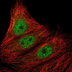 Invitrogen ARMC5 Polyclonal Antibody 100 &mu;L; Unconjugated:Antibodies,