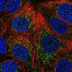 Invitrogen CHCHD4 Polyclonal Antibody 100 &mu;L; Unconjugated:Antibodies,