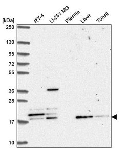 Invitrogen FAM96A Polyclonal Antibody 100 &mu;L; Unconjugated:Antibodies,