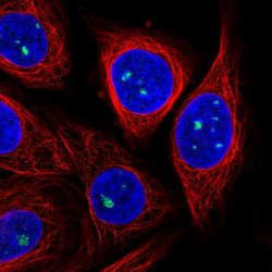 Invitrogen ZDHHC14 Polyclonal Antibody 100 &mu;L; Unconjugated:Antibodies,