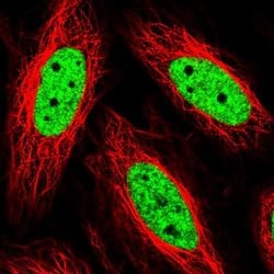 Invitrogen THRAP3 Polyclonal Antibody 100 &mu;L; Unconjugated:Antibodies,