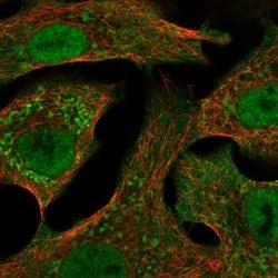 Invitrogen CYP24A1 Polyclonal Antibody 100 &mu;L; Unconjugated:Antibodies,