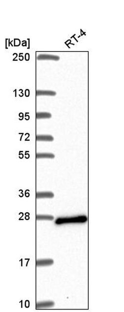 Invitrogen ARL15 Polyclonal Antibody 100 &mu;L; Unconjugated:Antibodies,