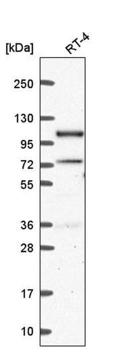 Invitrogen SMEK1 Polyclonal Antibody 100 &mu;L; Unconjugated:Antibodies,