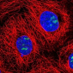 Invitrogen NOC3L Polyclonal Antibody 100 &mu;L; Unconjugated:Antibodies,