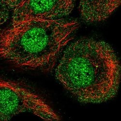 Invitrogen™ AKNA Polyclonal Antibody