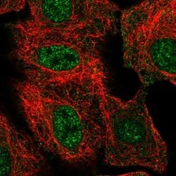 Invitrogen THAP8 Polyclonal Antibody 100 &mu;L | Buy Online | Invitrogen&trade; | Fisher Scientific